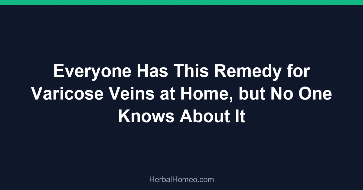 Everyone Has This Remedy for Varicose Veins at Home, but No One Knows About It