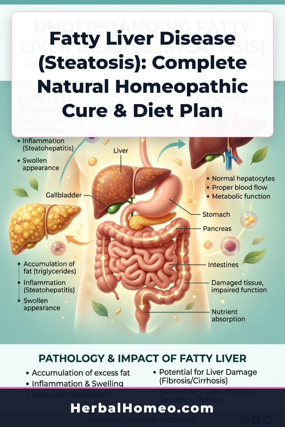 Fatty liver disease natural treatment infographic pin
