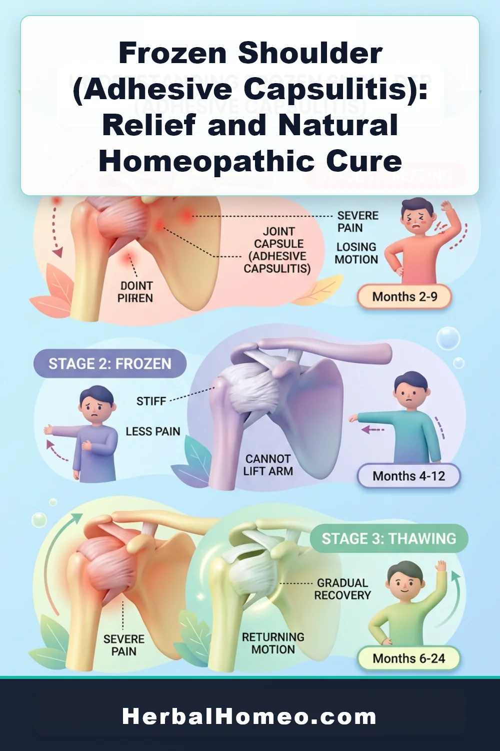 Frozen Shoulder Adhesive Capsulitis Homeopathy Infographic Pin