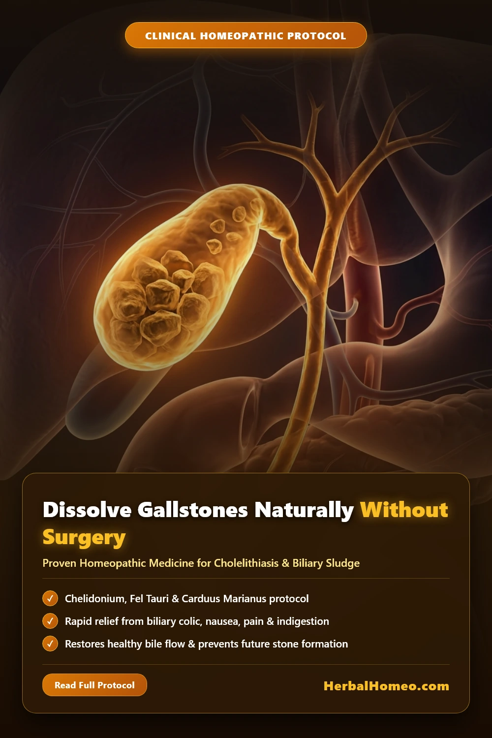 Gallstones Natural Homeopathic Treatment Pin